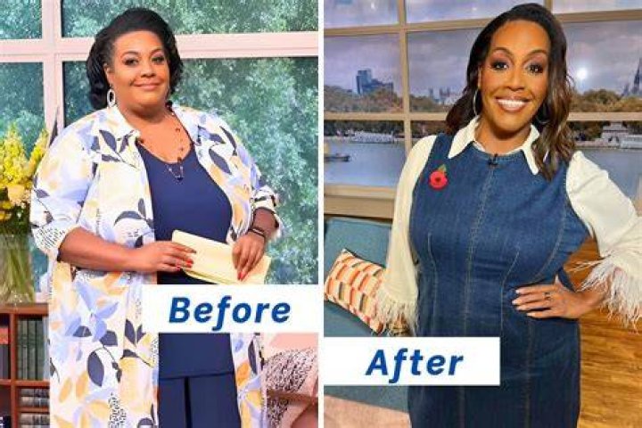 
Alison Hammond Surgery Before And After: Has She Recovered From Gastric Band? Health Update 