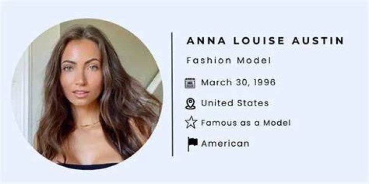 Anna Louise (Model) - Age, Family, Bio