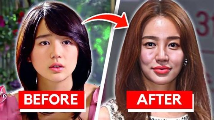 Did BoA Kwon Get Plastic Surgery?Who is BoA Kwon?
