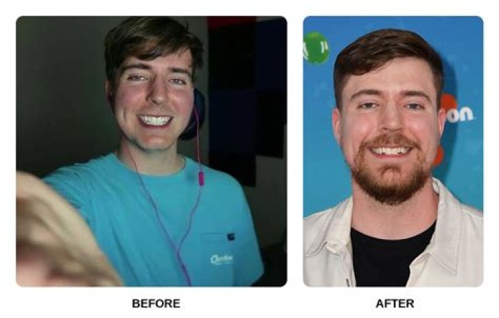 Did Joel Dommett Have His Teeth Done? Fans Are Debating About His Gorgeous Set Sharing Before And After Pictures