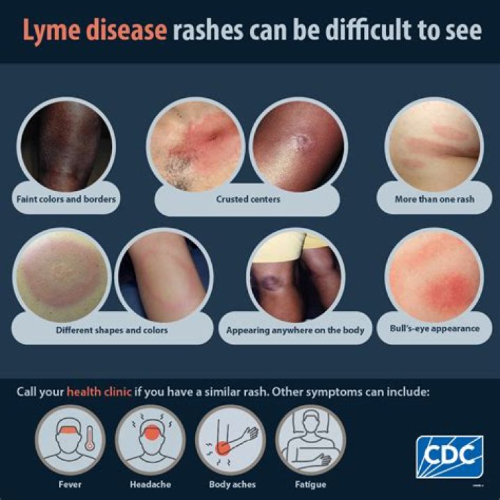 Does lime repel ticks?