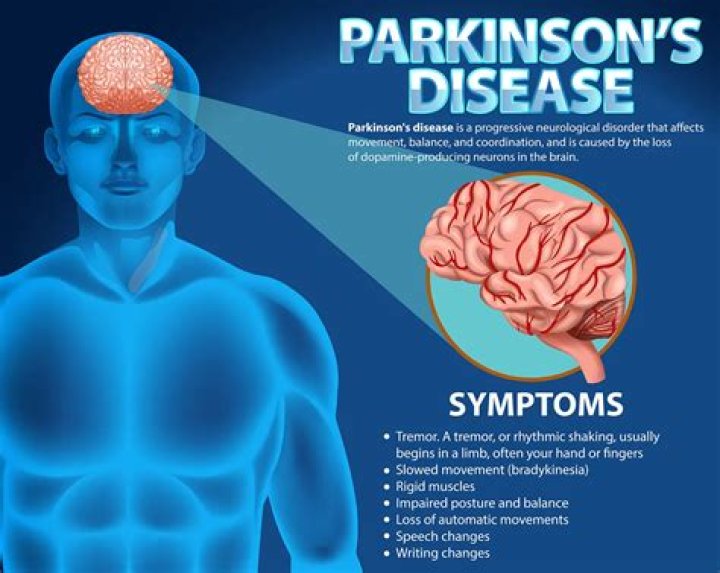 Does Liza Minnelli Have Parkinsons? Health Problems & Illness -Details To Know