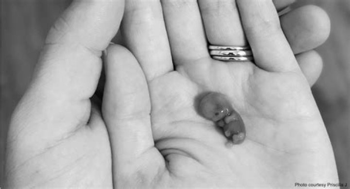 Duggar family shares pics at miscarried baby’s memorial showing her tiny hands & feet