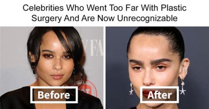 Here The Real Reason Why Emily Compagno Got Plastic Surgery