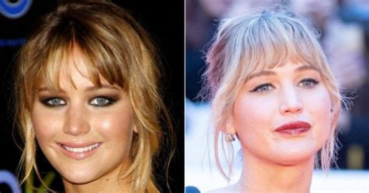 Did Jennifer Lawrence undergo cosmetic surgery? Jennifer Lawrence has not undergone any cosmetic surgery on her face so far (1)