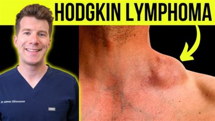 John Green Cancer: Does He Have Lymphoma?