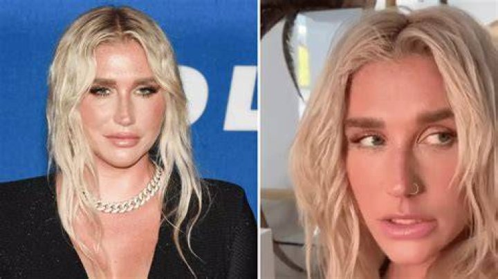 Kesha Almost Died With Major Complications While Freezing Her Eggs Earlier This Year! Kesha Almost Died With Major Complications While Freezing Her Eggs Earlier This Year!