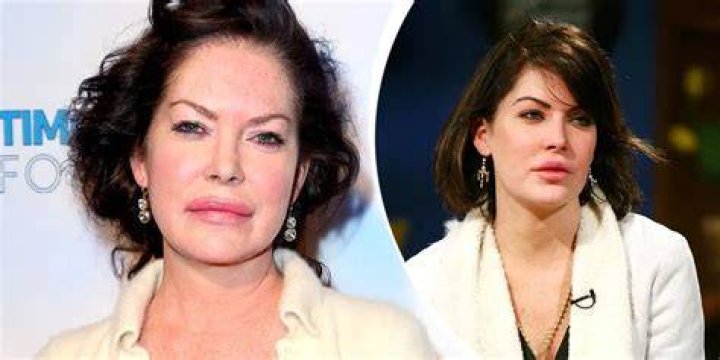 Lara Flynn Boyle’s “face looks like it’s melting,” says cosmetic surgeon