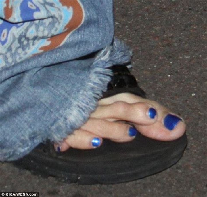 	LeAnn Rimes posts photo of her feet to ‘prove’ her injury: gross or funny?	