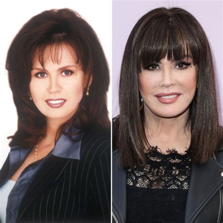 Marie Osmond had so much plastic surgery she looks like one of those dolls she sells