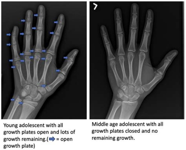 Max Wrist - Age, Family, Bio