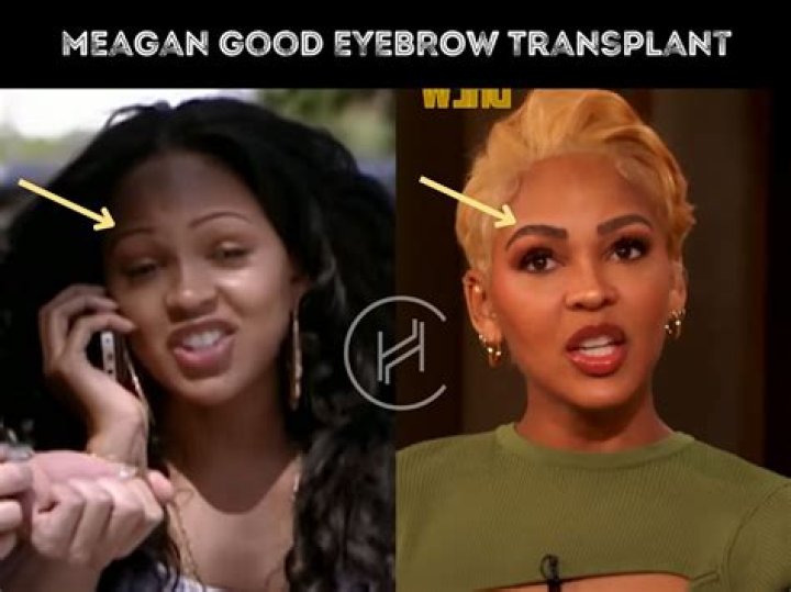 Meagan Good got an eyebrow transplant: ‘After destroying my eyebrows, there’s hope’