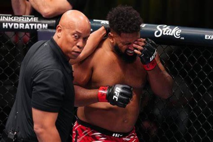 
Michael Bisping Eye Injury – Does He Wear An Eye Glass? Actor’s Injury Explained 