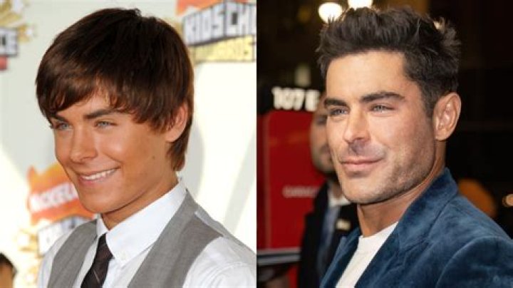 People were talking about Zac Efron’s face, but does he really look that different??