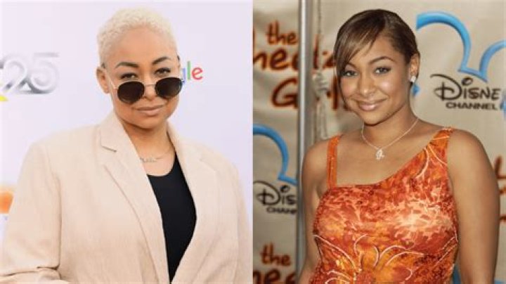 Raven Symone had two breast reductions and lipo as a teen