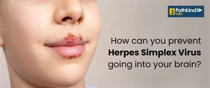 “The Herpes blind item everyone is talking about” links