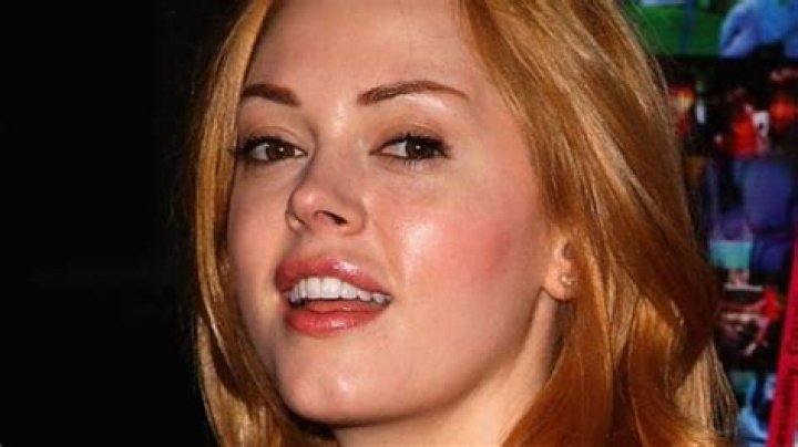 The story behind Rose McGowan’s droopy eye(s)