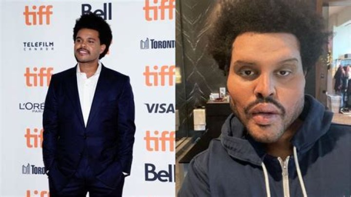 The Weeknd looks rough in NYC!