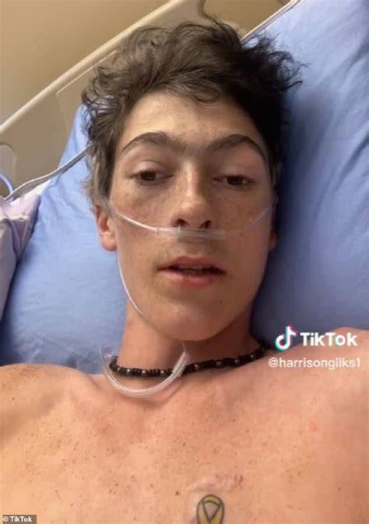 TikTok star Harrison Gilks dies at an early age due to a cancer&nbsp;&nbsp;