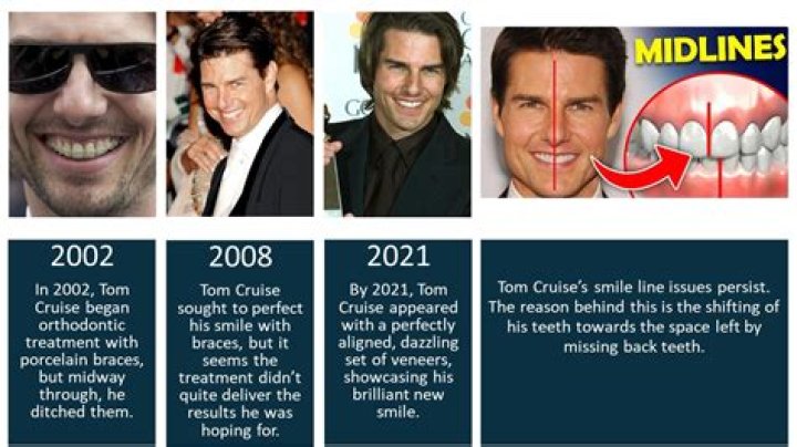 Tom Cruise Teeth – The Truth About The Actor’s Distinctive Misaligned Middle Tooth Revealed