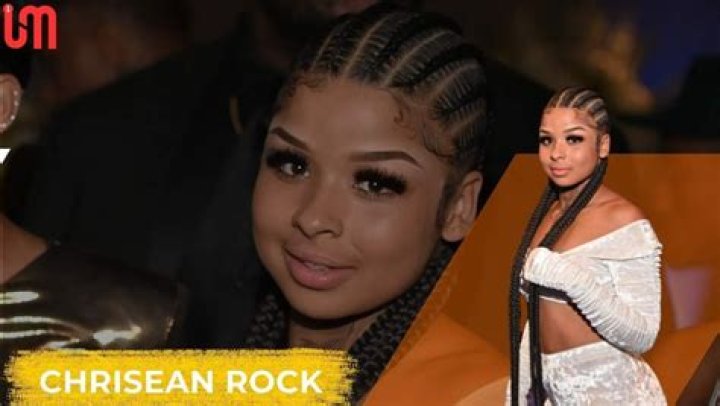 Wait, What? Chrisean Rock Has Finally Got Her New Teeth!!!