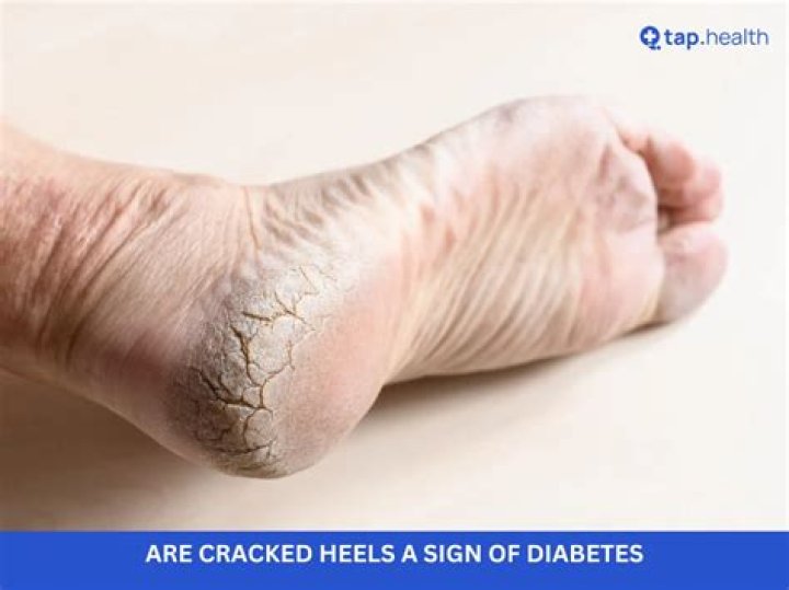What does clicking your heels mean?