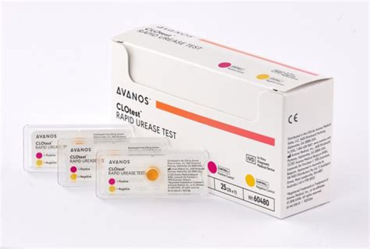 What is a urease test used for?