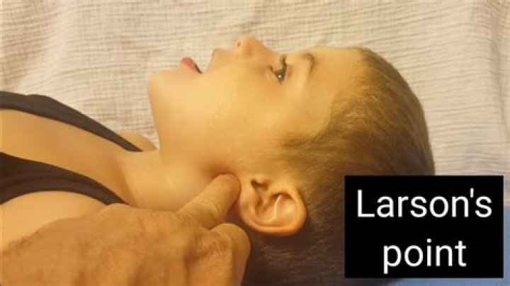 What is Larson’s maneuver?