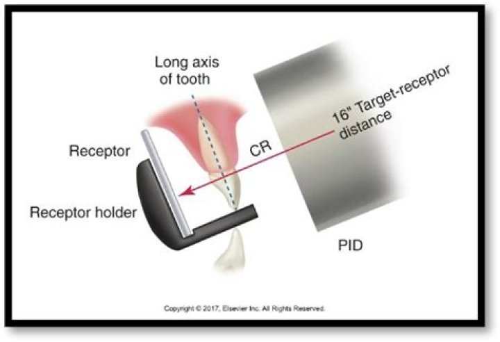 What is paralleling technique in dental radiography?