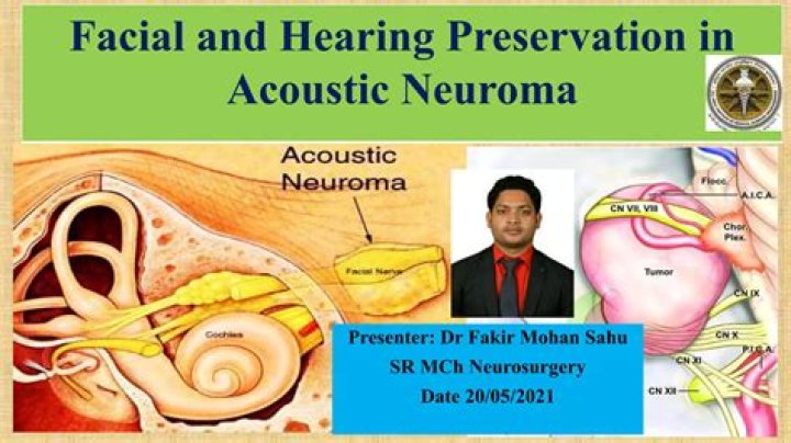 What is the diagnosis code for acoustic neuroma?
