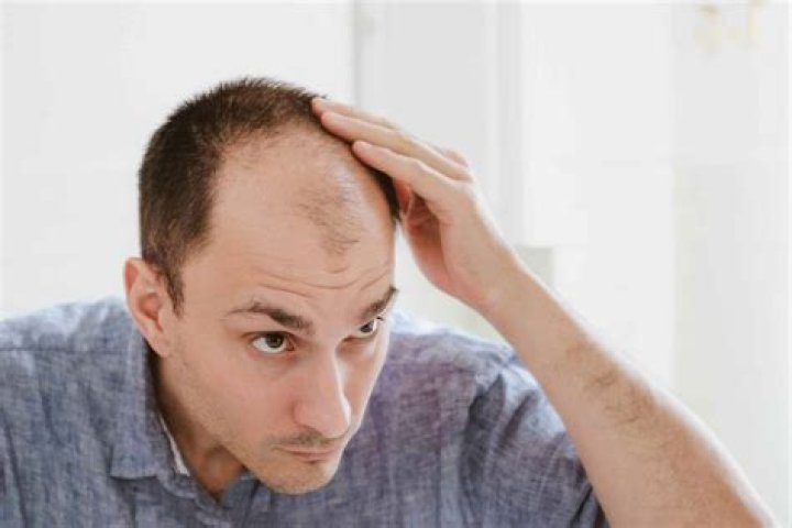 What is the reason of the baldness of Dr. Imani Walker? Is it genetics, cancer, or personal choice?