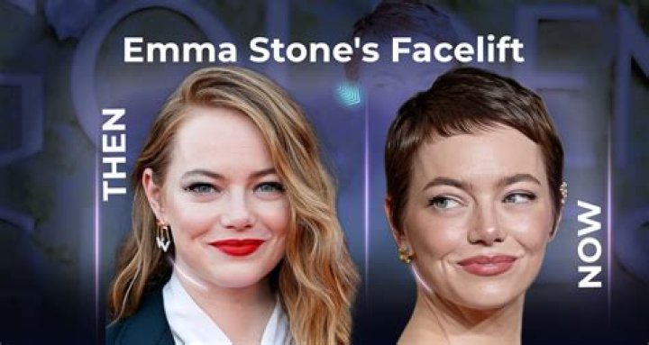 Who is Emma Stone’s new boyfriend? Know the latest on her relationship status and dating timeline! Who is Emma Stone’s new boyfriend? Know the latest on her relationship status and dating timeline!