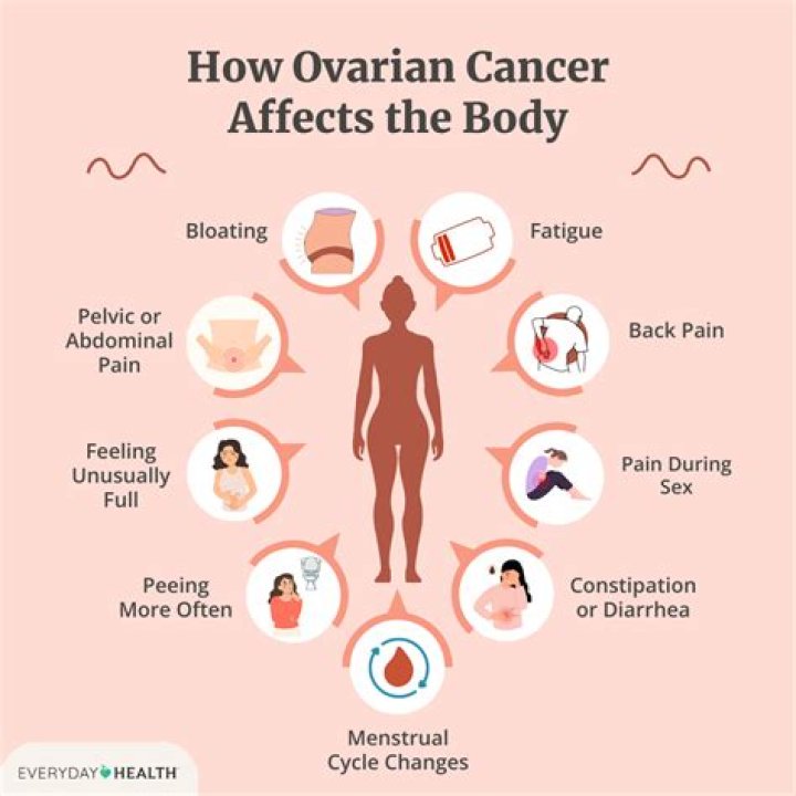
Who Is Hannah Catton? How Are Ovarian Cancer and Weight Gain Related? 