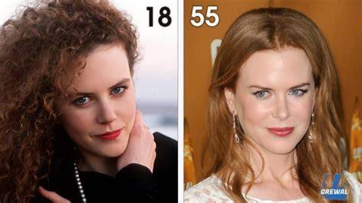 Why is everyone talking about Nicole Kidman’s years-old boob job now?