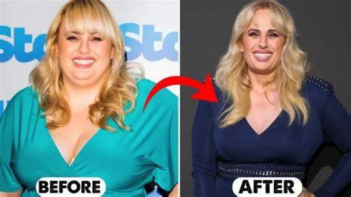 
Zooey Deschanel Weight Loss Journey – Before And After Photos 